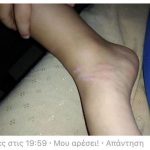 Απελπισία με τα κρούσματα τσιμπήματος τσούχτρας στον Κορινθιακό